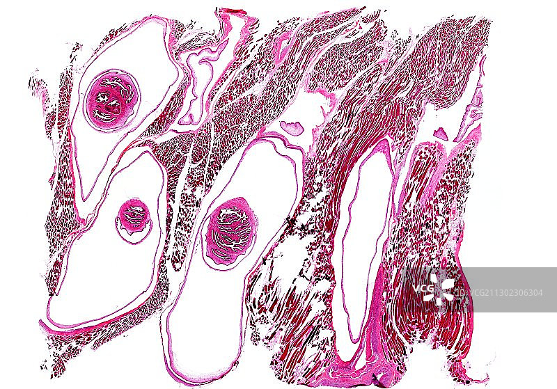 猪肉绦虫感染显微照片图片素材
