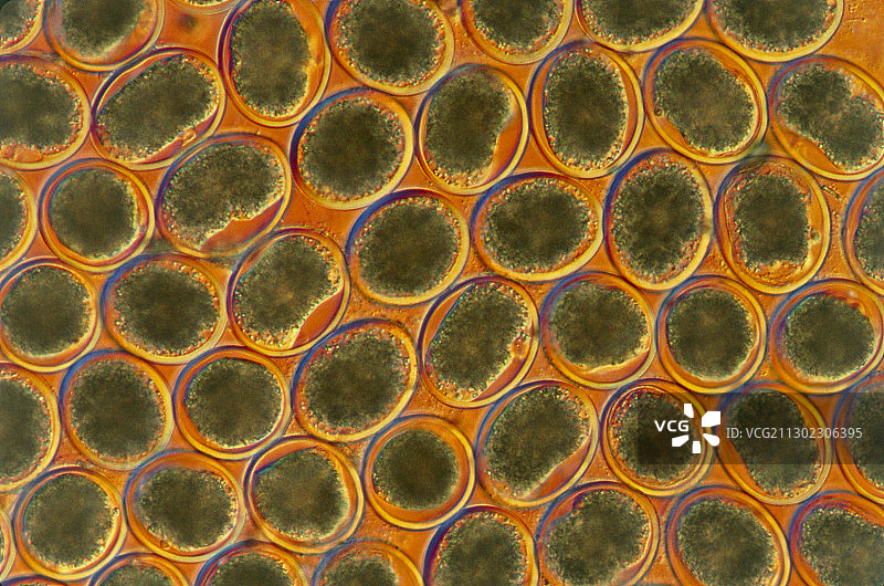 弓蛔虫卵，x65，橙色背景图片素材