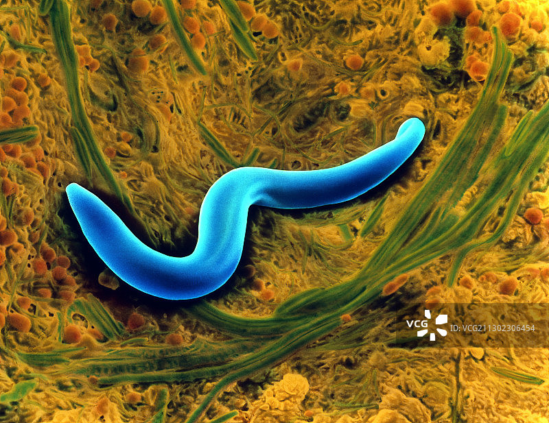 土壤线虫的彩色扫描电镜图像图片素材