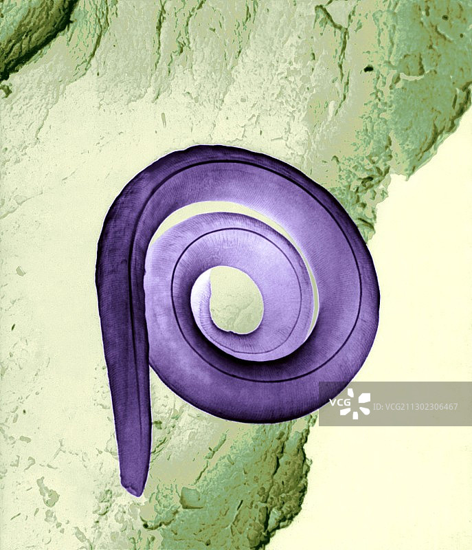 线虫，扫描电子显微镜图图片素材