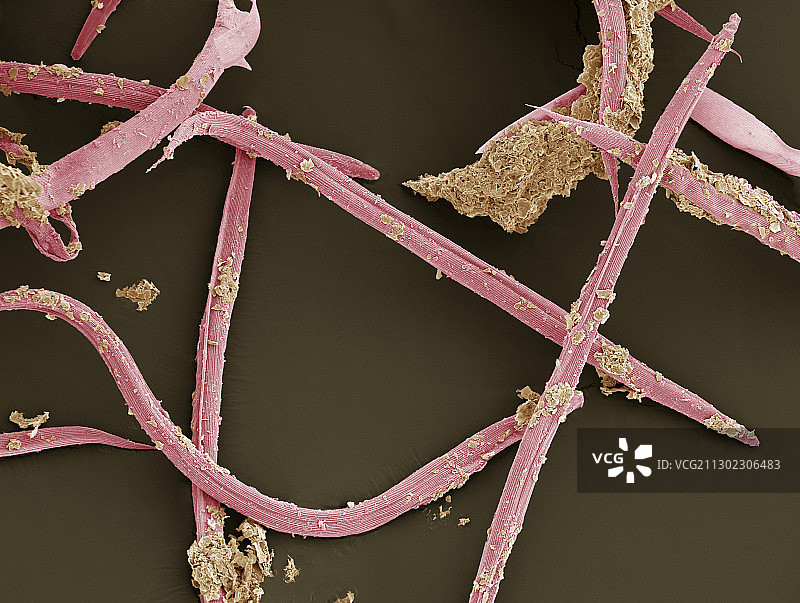 线虫（扫描电镜图）图片素材