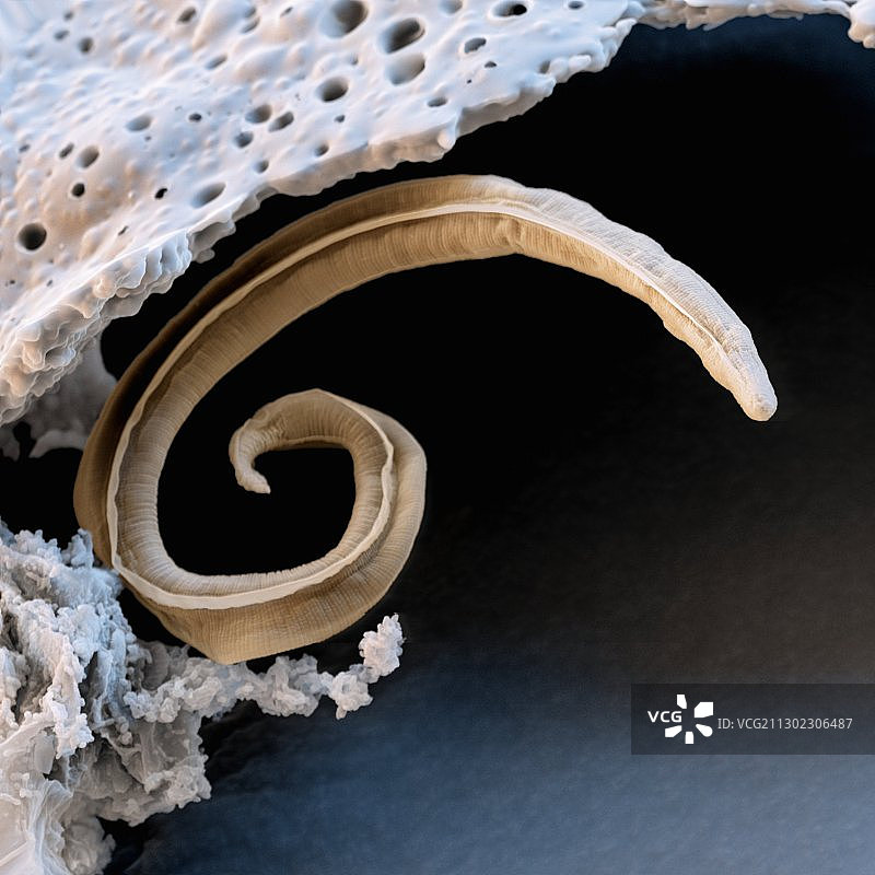 犬肺丝虫扫描电镜图图片素材