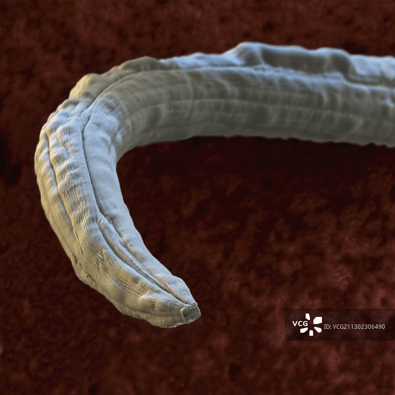 犬肺丝虫扫描电镜图图片素材