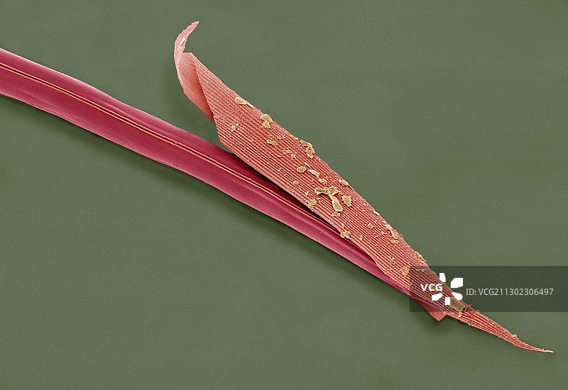 线虫（扫描电镜图）图片素材