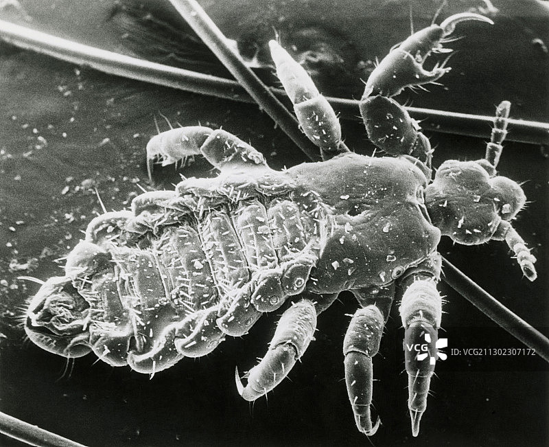 吸血人体/头虱的扫描电镜图像图片素材