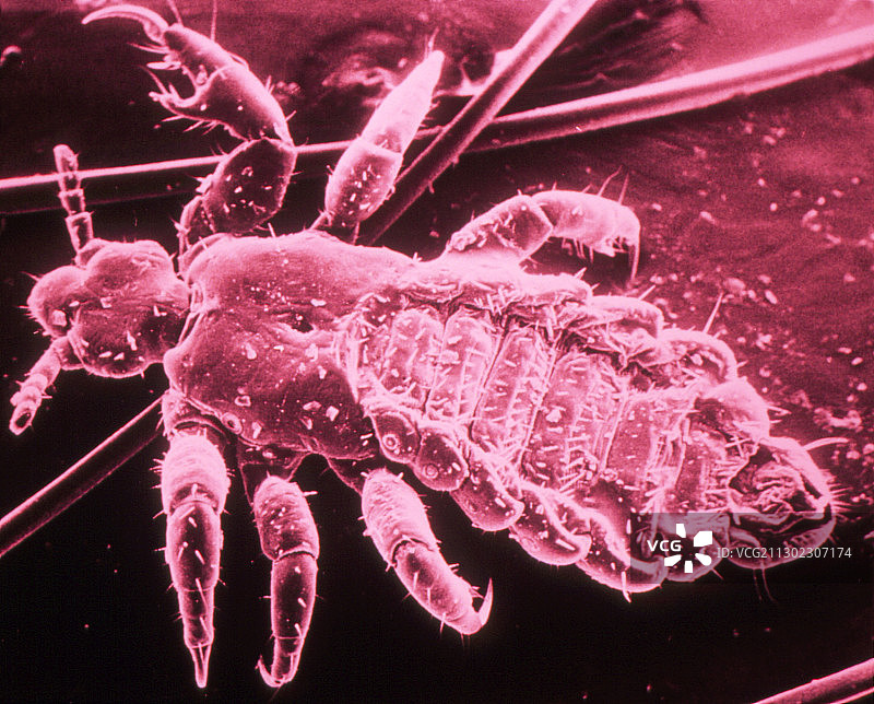 人体/头虱在头发上的假彩色扫描电镜图片素材