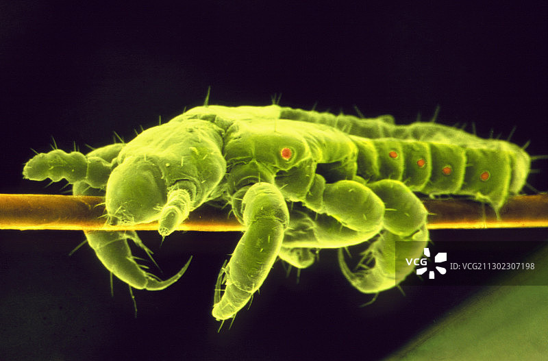 头虱在头发上的扫描电镜照片图片素材