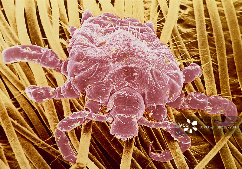 阴虱扫描电镜图图片素材