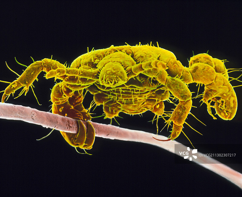 人体毛发上的阴虱彩色扫描电镜图像图片素材