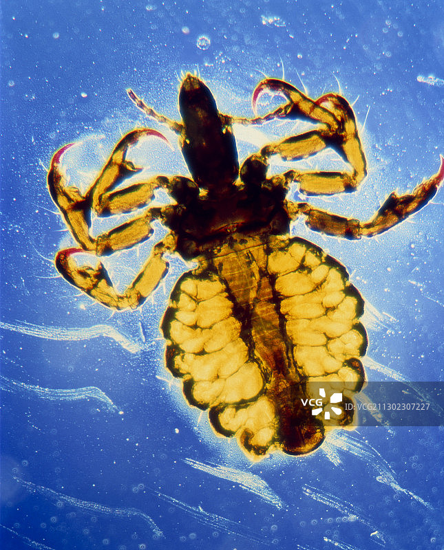 人虱，人 Pediculus corporis 的光学显微镜图像图片素材