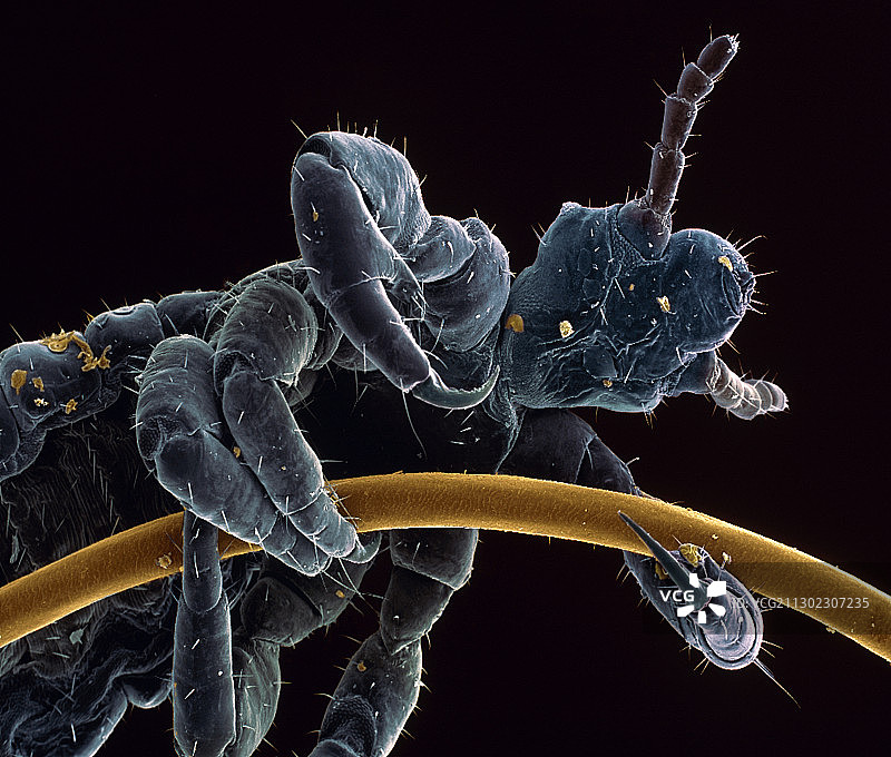 头虱，扫描电子显微镜图片素材