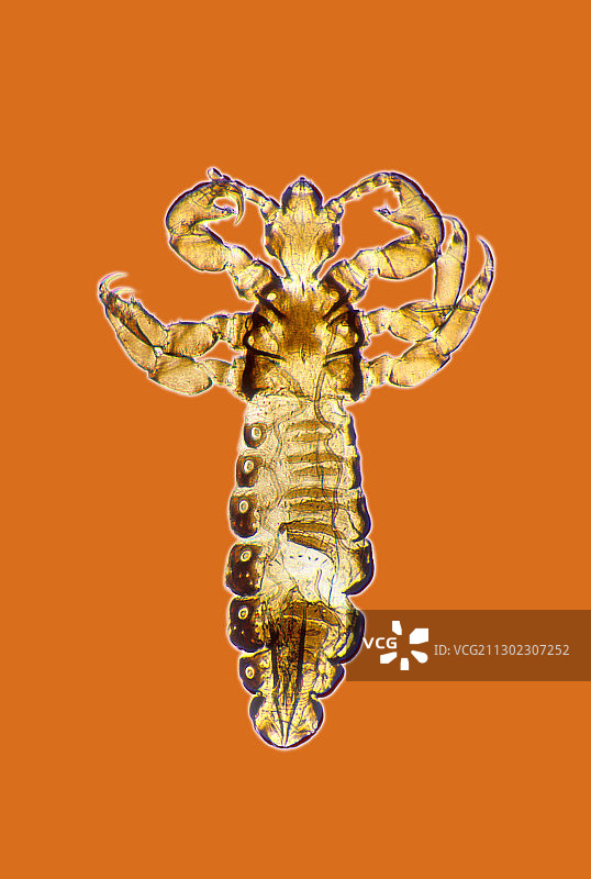 人体虱子图片素材