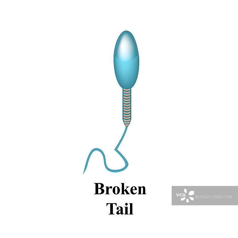 男性射精病理形态精子图片素材