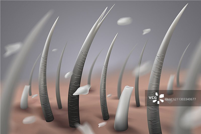 受损的灰发图片素材