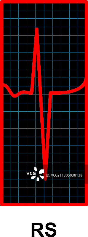 红色心跳脉冲监视器心电图和心脏符号图片素材