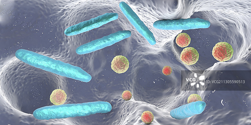 牙洞内的细菌，图示图片素材
