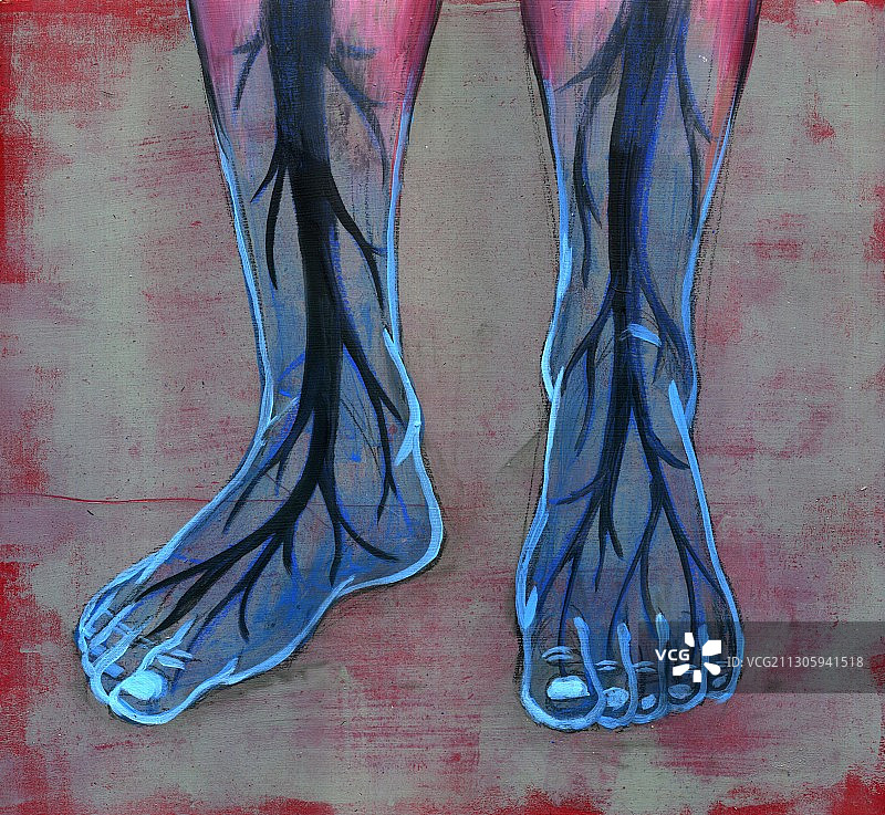 糖尿病患者的蓝色脚部插图图片素材