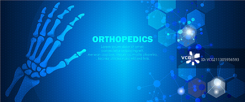 医学手部骨骼损伤图片素材