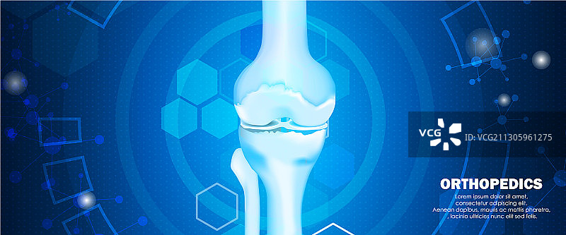 医用骨科膝骨图片素材