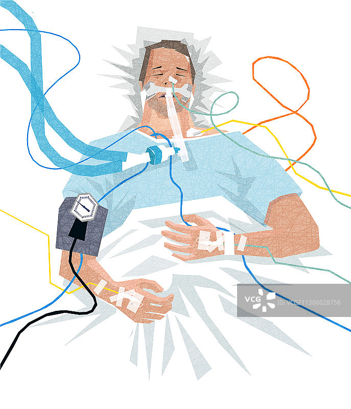 使用呼吸机的COVID-19住院患者图片素材