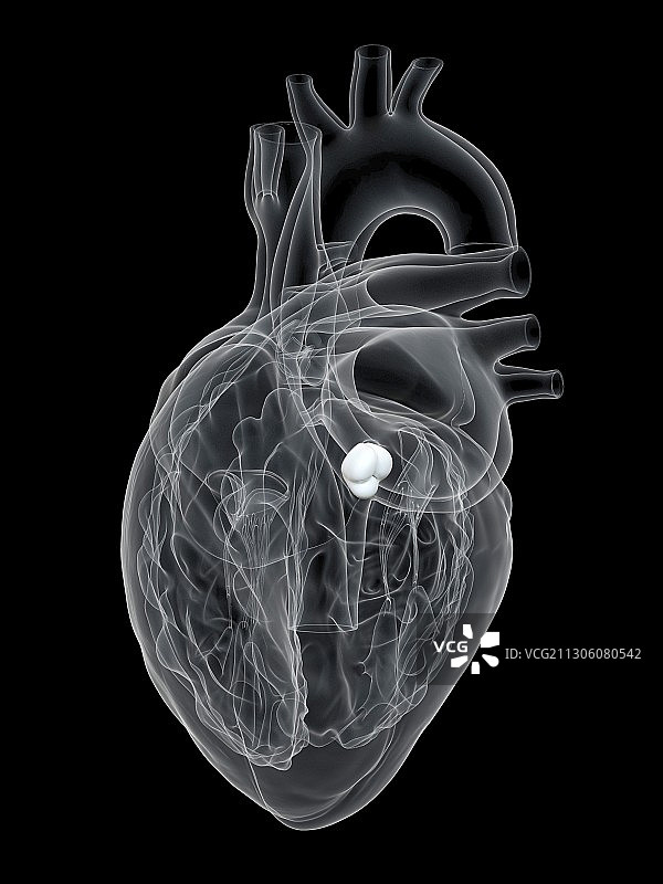 人类心脏主动脉瓣插图图片素材