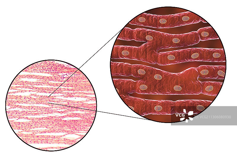 心肌结构示意图与显微照片图片素材