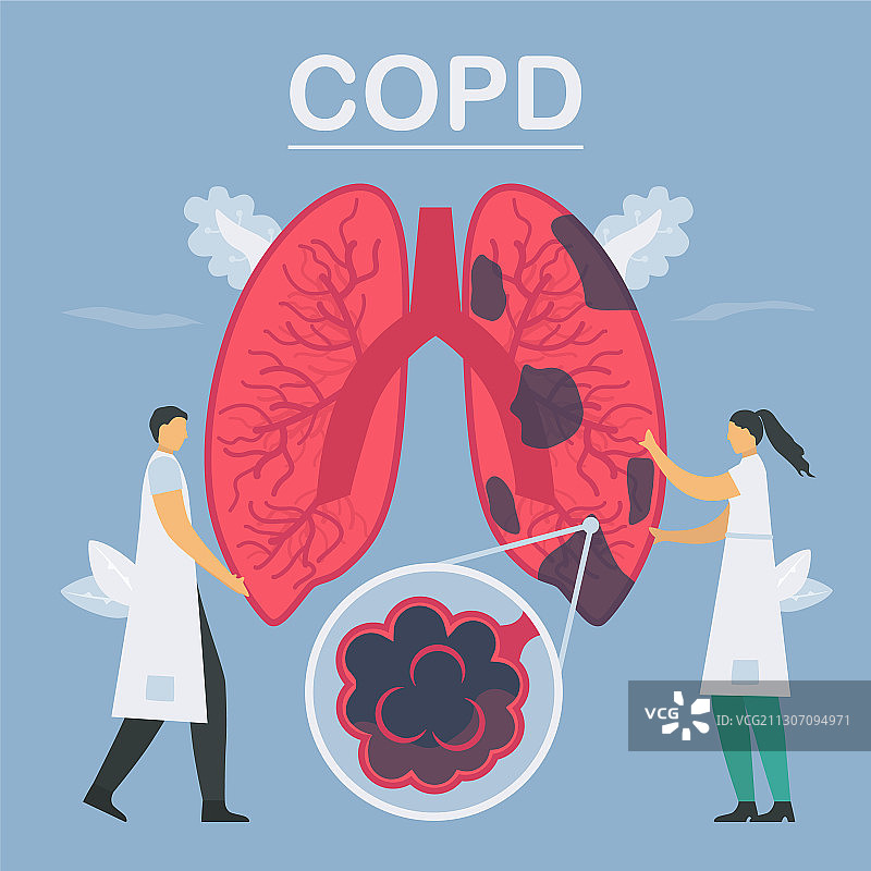 慢性阻塞性肺病图片素材
