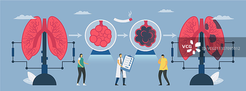 慢性阻塞性肺病图片素材