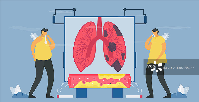 吸烟会导致慢性阻塞性肺病图片素材