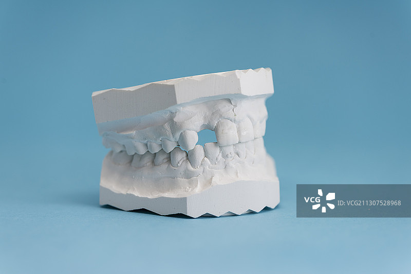 人类下颚的石膏模型/牙科印模图片素材
