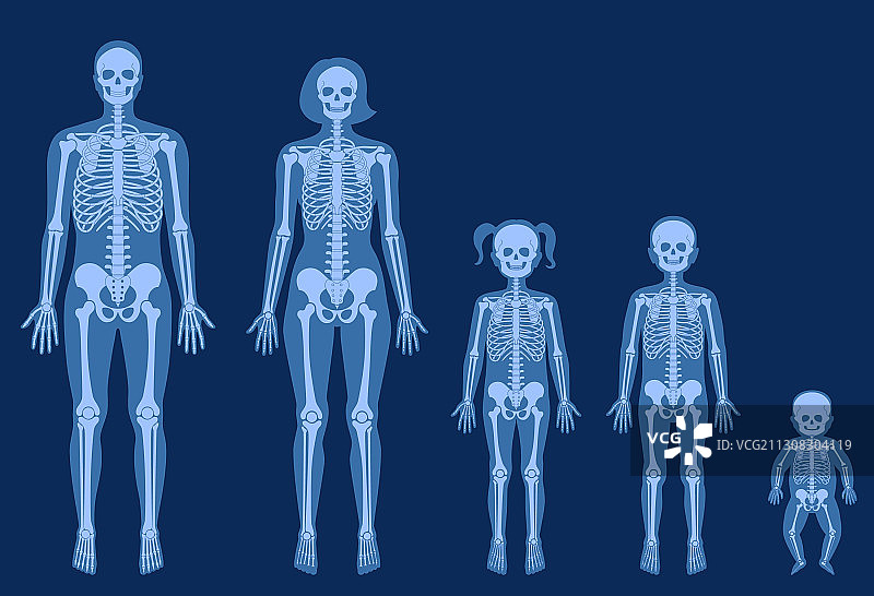 骷髅X光片图片素材