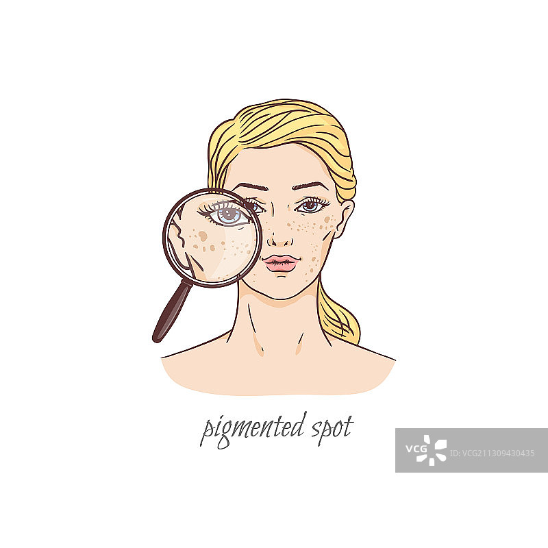 面部色素斑点皮肤护理问题卡通图片素材