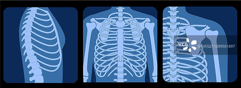 骷髅X光片图片素材