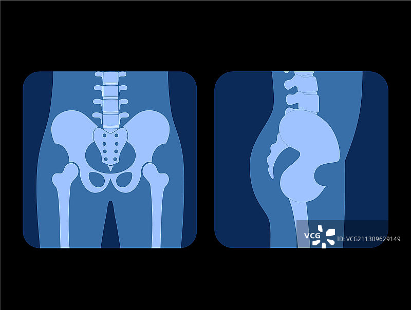 骷髅X光片图片素材