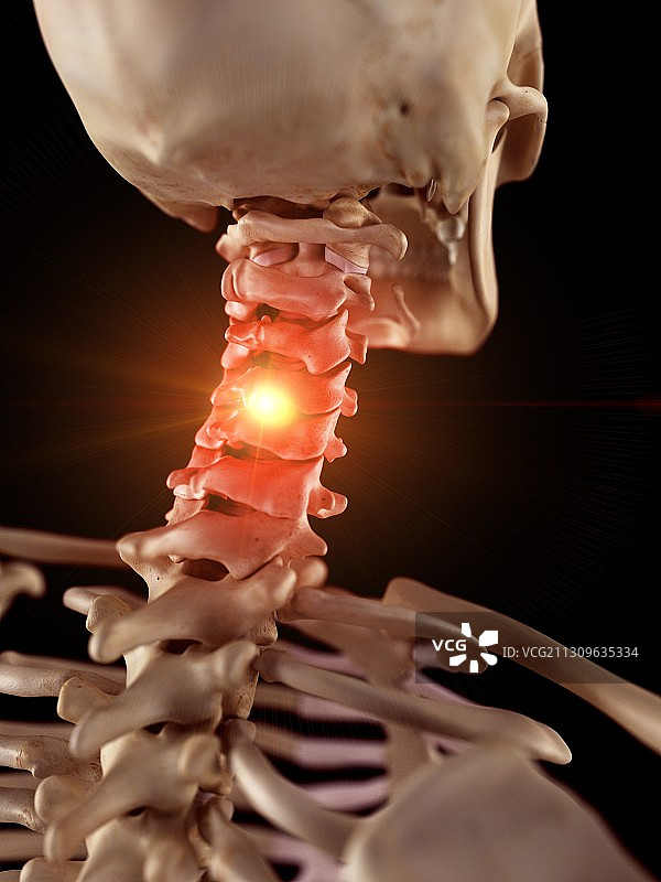 颈部疼痛插画图片素材