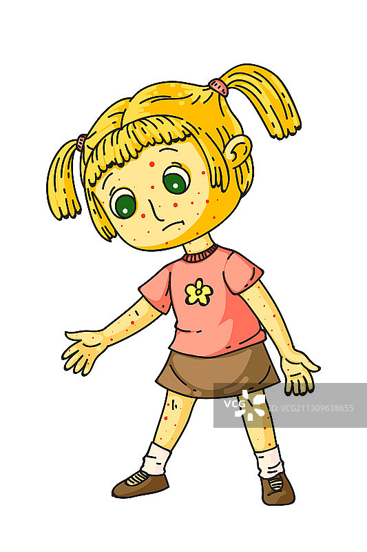患有皮疹的生病小女孩（白色背景，已隔离）图片素材