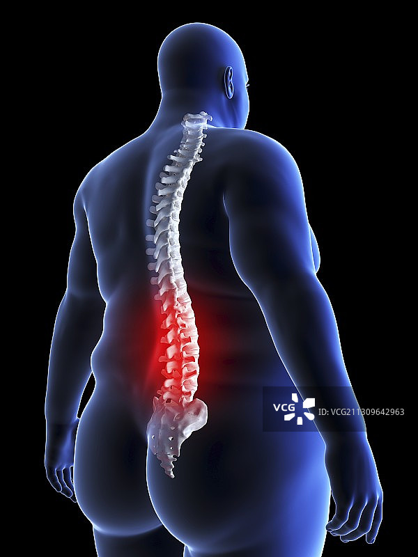肥胖男子背痛插图图片素材