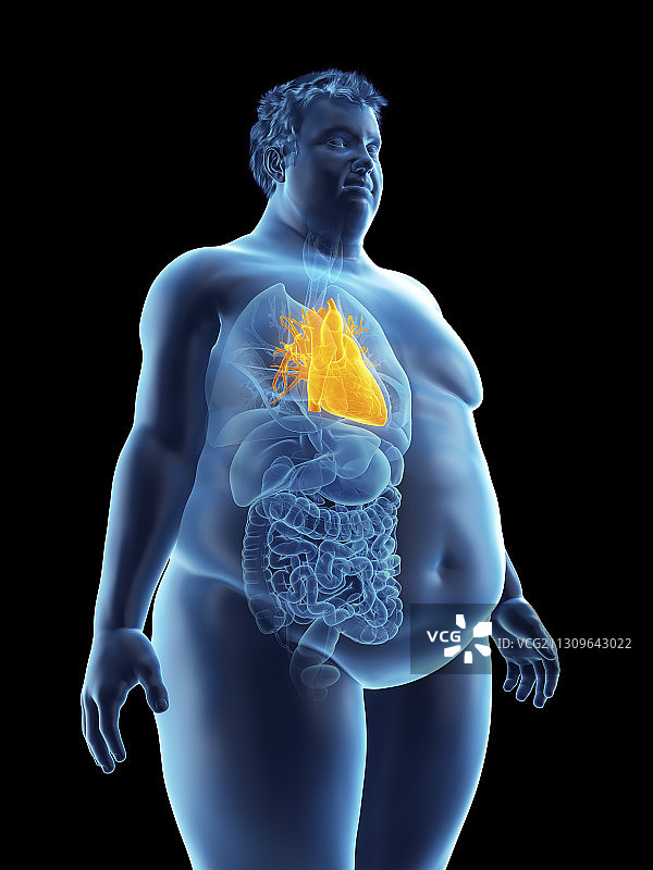 肥胖男子心脏的插图图片素材