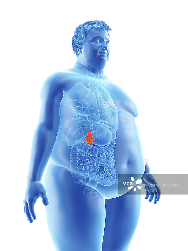 肥胖男人的胆囊插图图片素材
