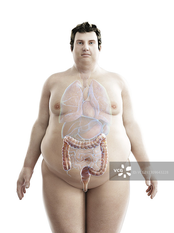 肥胖男子结肠插画图片素材