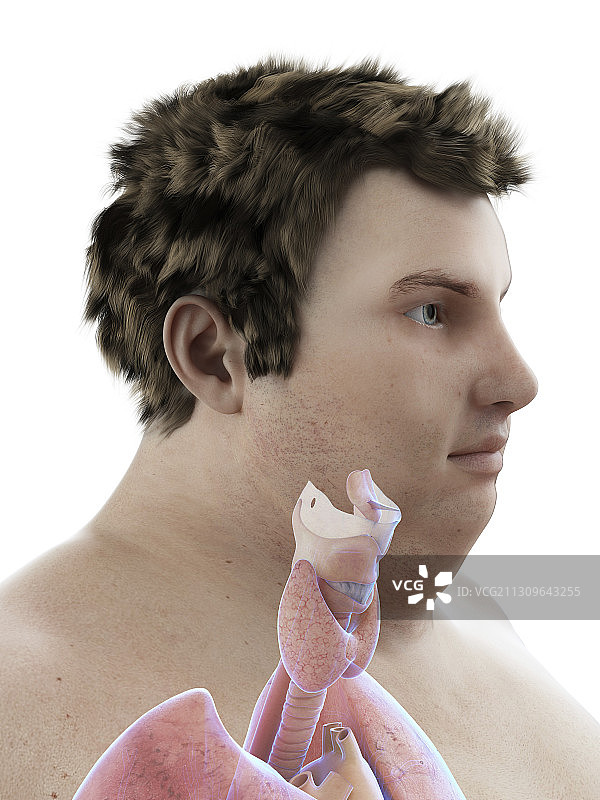 肥胖男人喉咙的解剖结构插画图片素材
