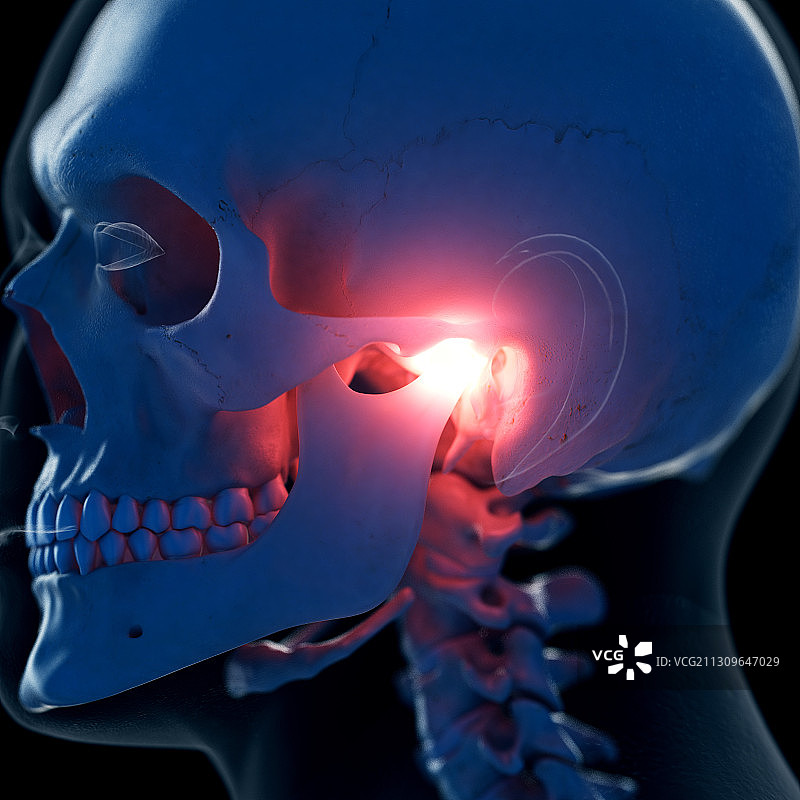 疼痛的颞下颌关节插画图片素材