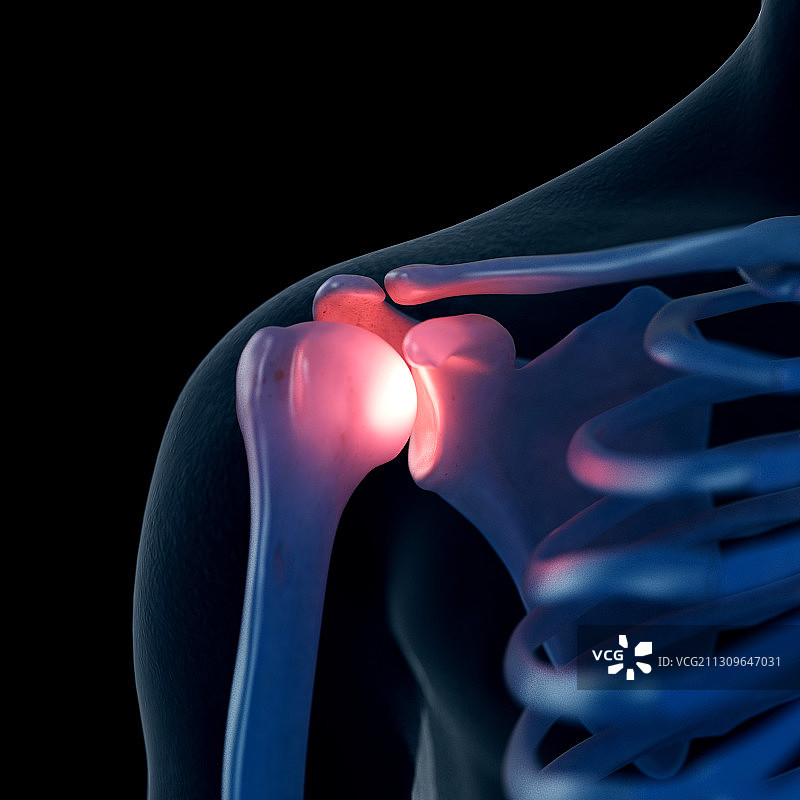 肩部疼痛插画图片素材