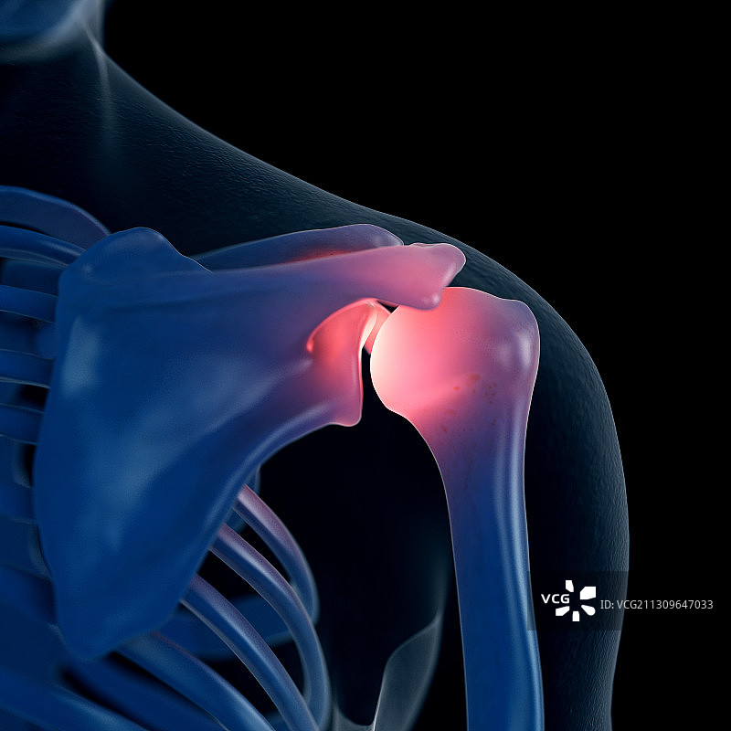 肩部疼痛插画图片素材