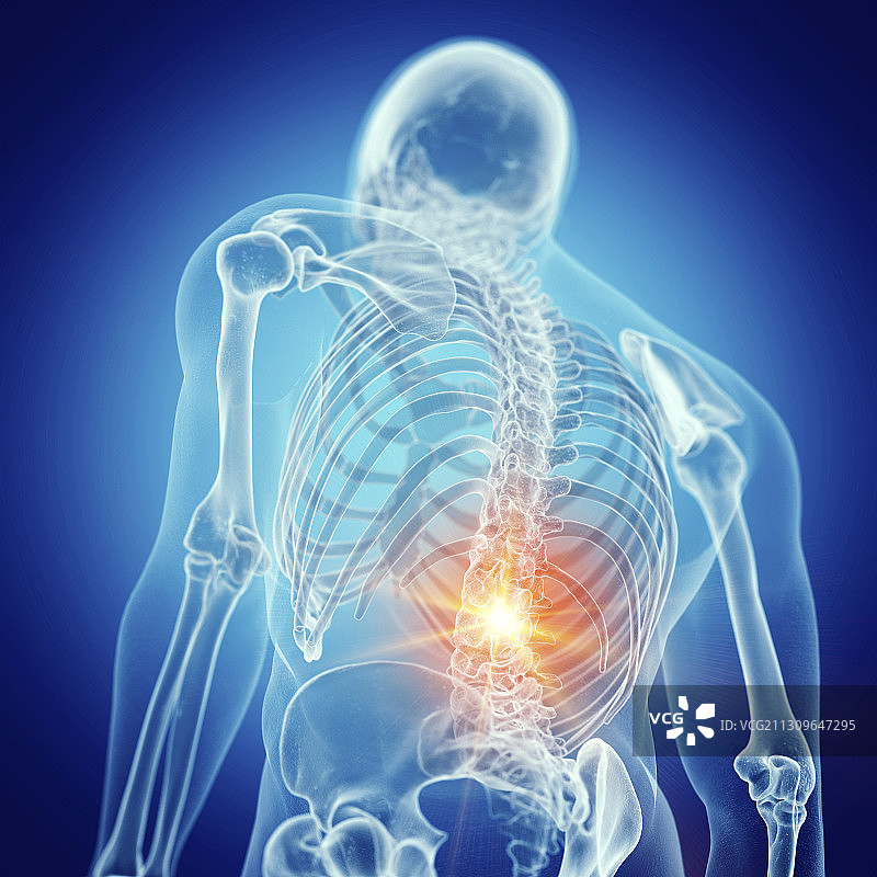 腰部疼痛的插画图片素材