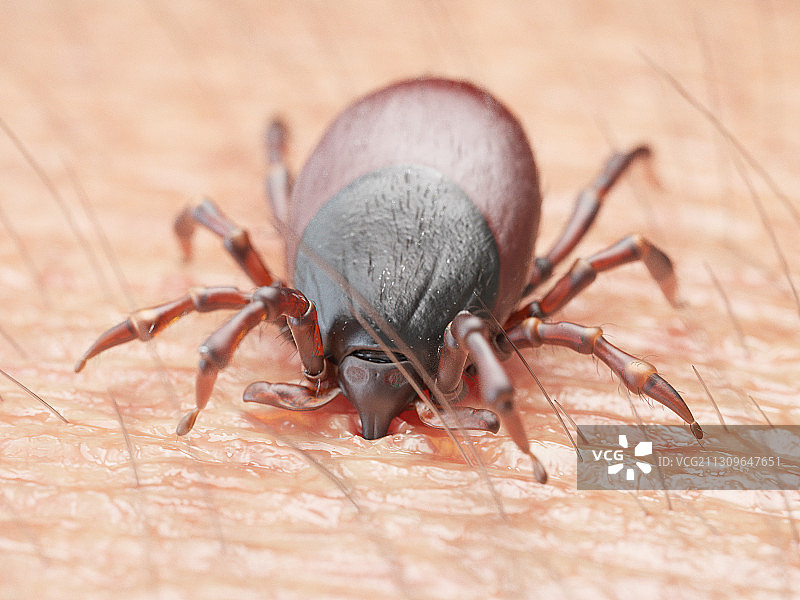 蜱虫叮咬人皮肤的插画图片素材