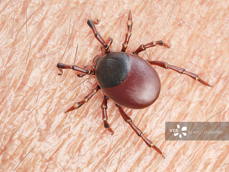 蜱虫叮咬人皮肤的插画图片素材