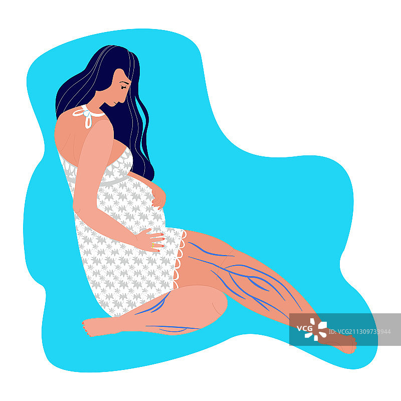 患有静脉曲张的年轻孕妇图片素材