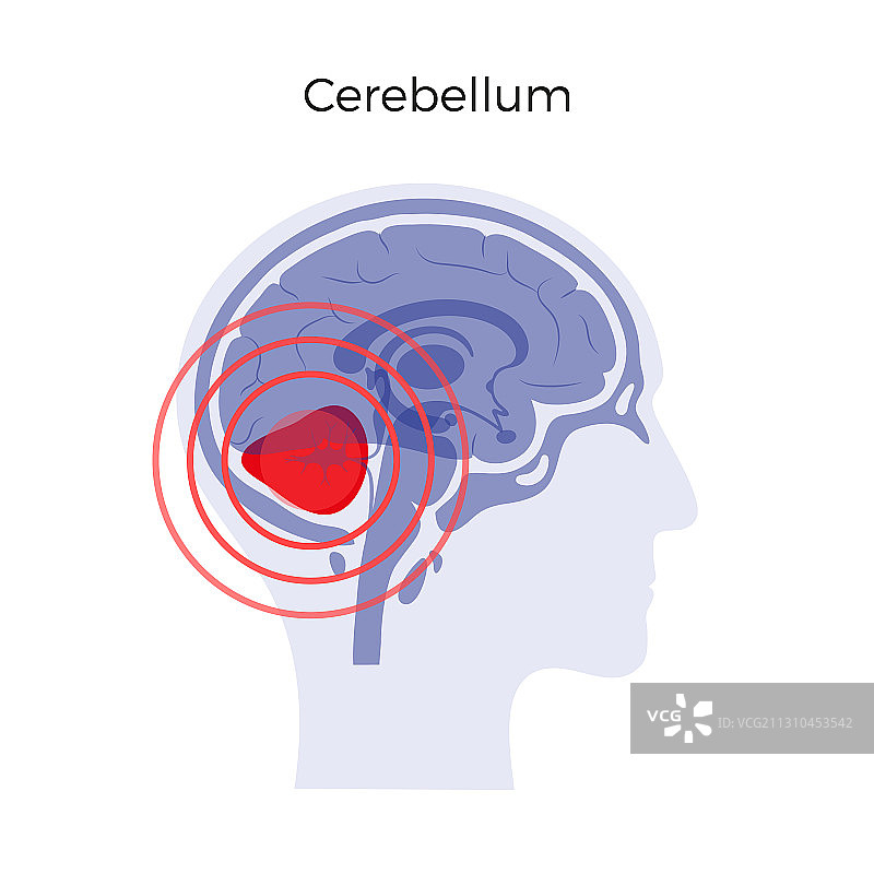 大脑疼痛图片素材