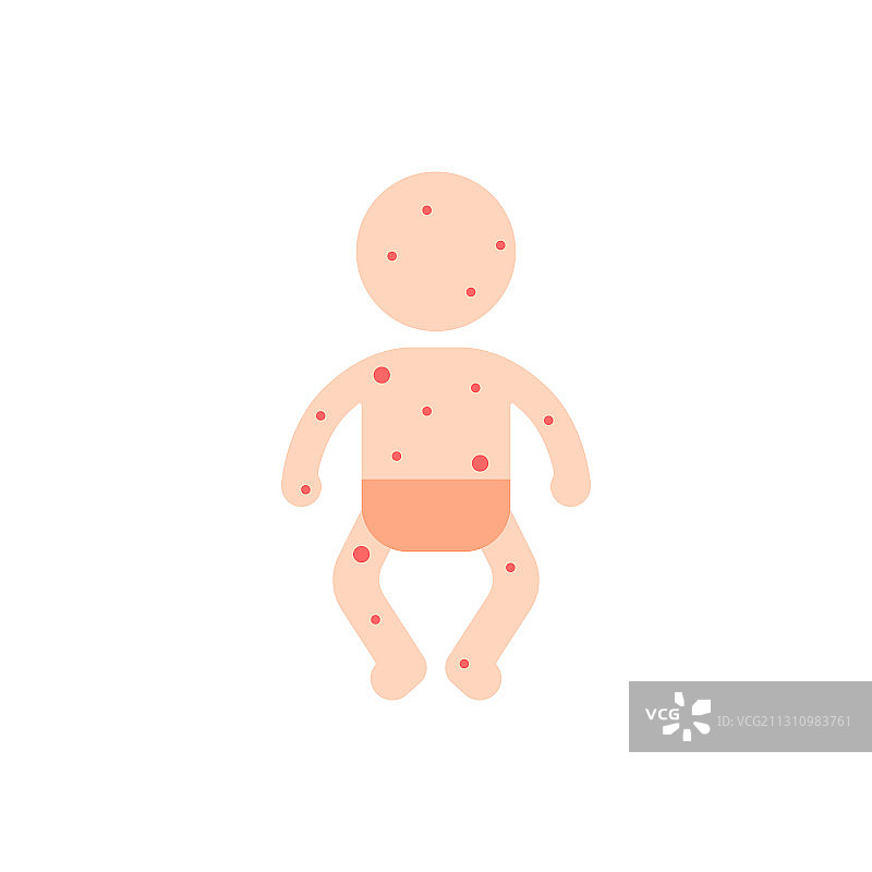 全身红点的婴儿图片素材